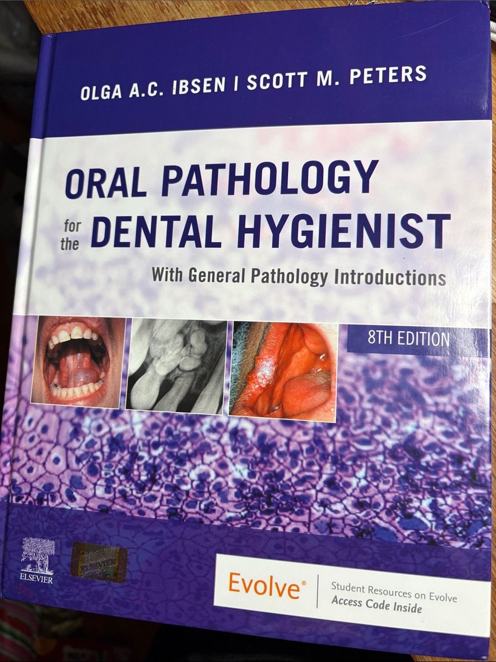 Oral Pathology for the Dental Hygienist by Olga A.C. Ibsen and Scott M. Peters